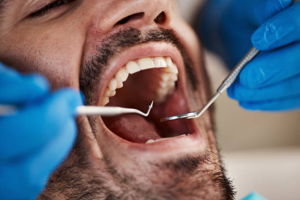 Best Emergency Dentist for Special Needs Patients in North Lewisburg, OH