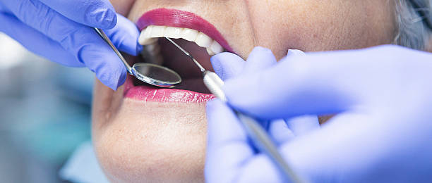 Best Holiday Emergency Dentist in North Lewisburg, OH